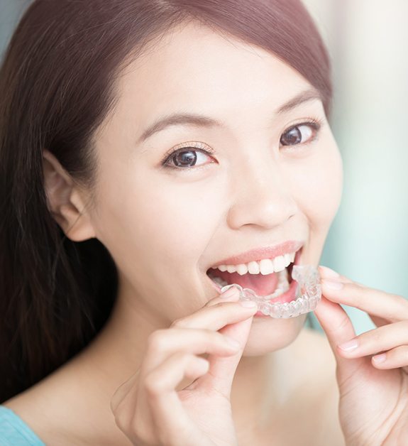 Woman placing an Invisalign tray