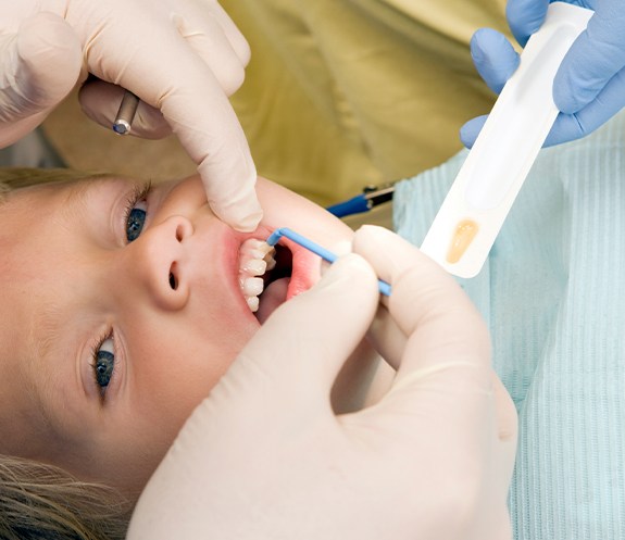 Patient receiving fluoride treatment