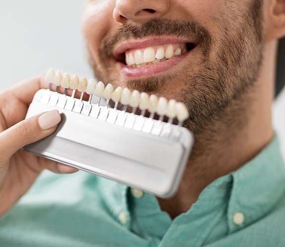 Man's smile compared with porcelain veneer shade chart