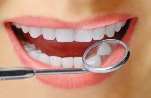 Chips, odd spaces and other defects detract from healthy smiles. Remake them with cosmetic bonding from Washington, DC dentist, Dr. Yelena Obholz.
