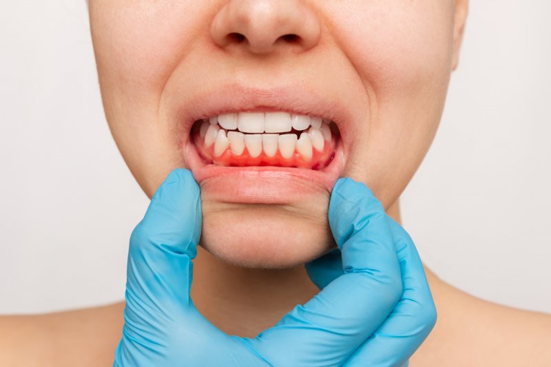 A dentist revealing a patient's gum disease